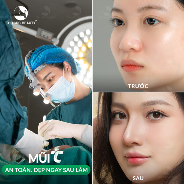 Thu Cúc Mega Beauty Center là địa chỉ thẩm mỹ uy tín, không chỉ bao gồm các dịch vụ phun xăm, công nghệ cao mà còn cung cấp cả dịch vụ tiểu phẫu, mang vẻ đẹp hoàn hảo cho khách hàng.