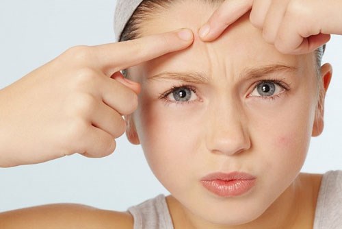 Những điều cần tránh khi chăm sóc da mặt bị mụn thâm