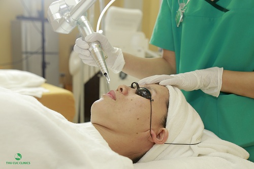 Khách hàng trị nám da mặt bằng Laser YAG Q-Switched tại Thu Cúc Clinics.