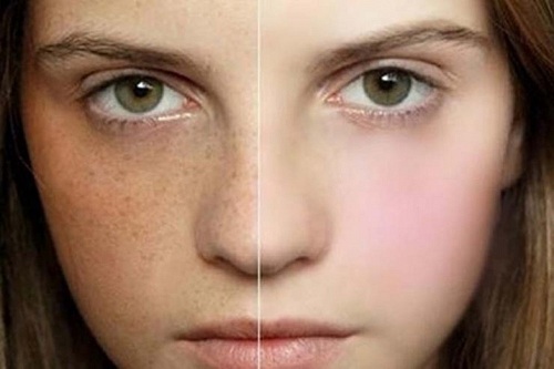 Đắp mặt nạ trị nám cho hiệu quả rất nhanh chóng với những trường hợp nám mới hình thành trên bề mặt da. 