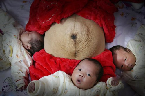 … Thậm chí là thâm đen, khó coi như thế này. Đây là hình ảnh của một bà mẹ Trung Quốc sau ca sinh ba và được chính người chồng đăng lên.