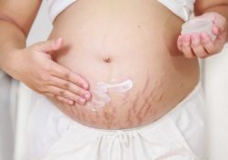 Dấu hiệu rạn da khi mang thai và cách phòng tránh