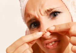 4 cách trị mụn cá ở mũi không bị tổn thương da