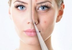 Thay da sinh học collagen có hại không?