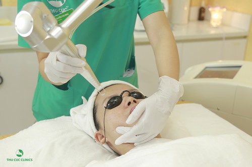 Phương pháp điều trị tàn nhang bằng công nghệ Laser YAG tại Thu Cúc Clinics.