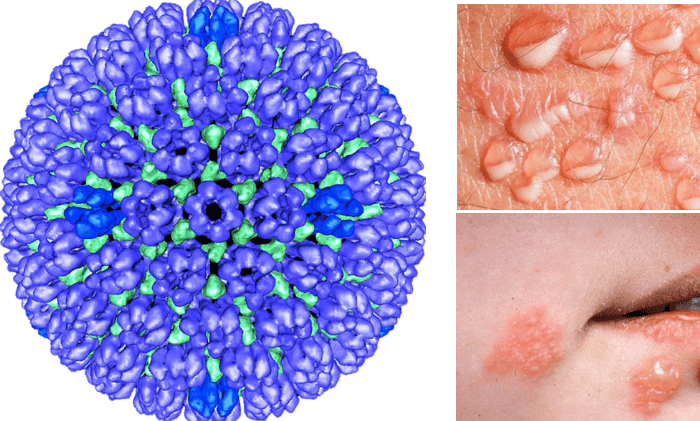 Virus HSV gây mụn rộp có khả năng lây truyền rất nhanh và qua nhiều con đường