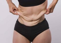 7 cách “xử lý” làn da chảy xệ sau khi giảm cân